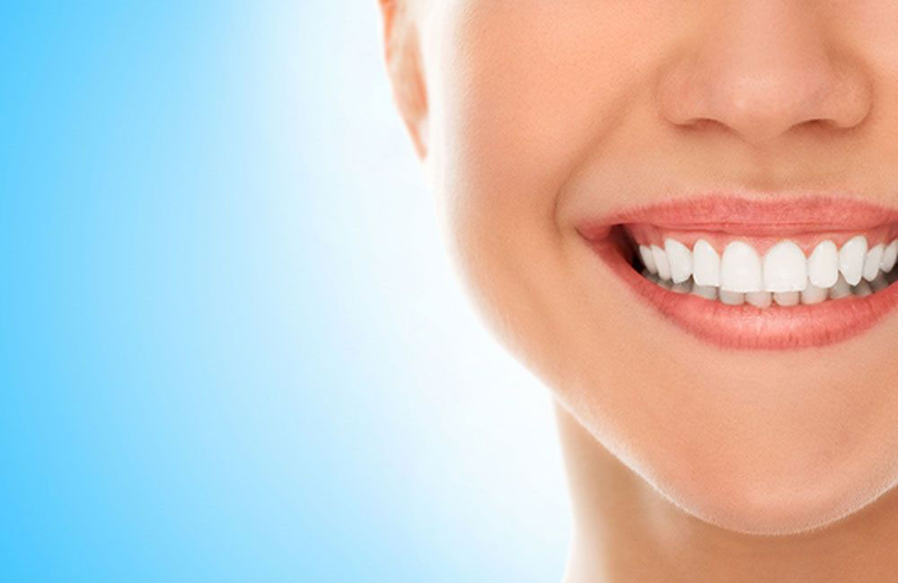 When should you use porcelain veneers?