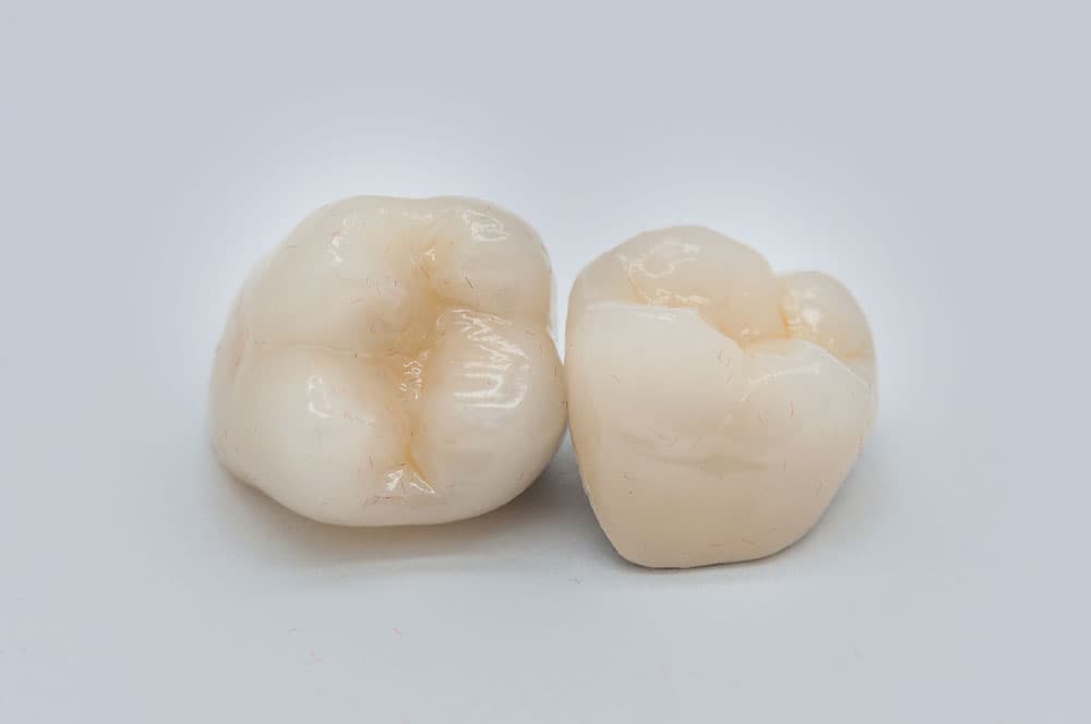 Zirconia full-ceramic teeth