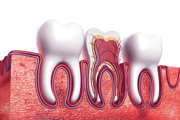 Standard root canal treatment